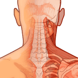 Neck Pain