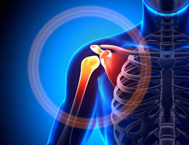 Having shoulder or neck pain? Always mind your posture