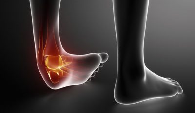 How long until I’m fully recoved from my injuries?