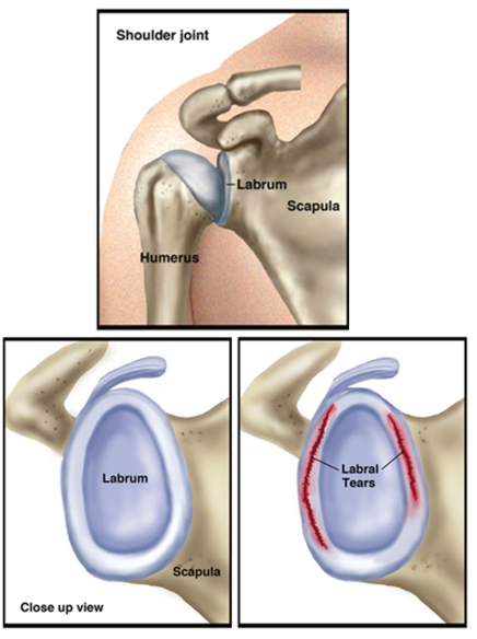 Shoulder Joint