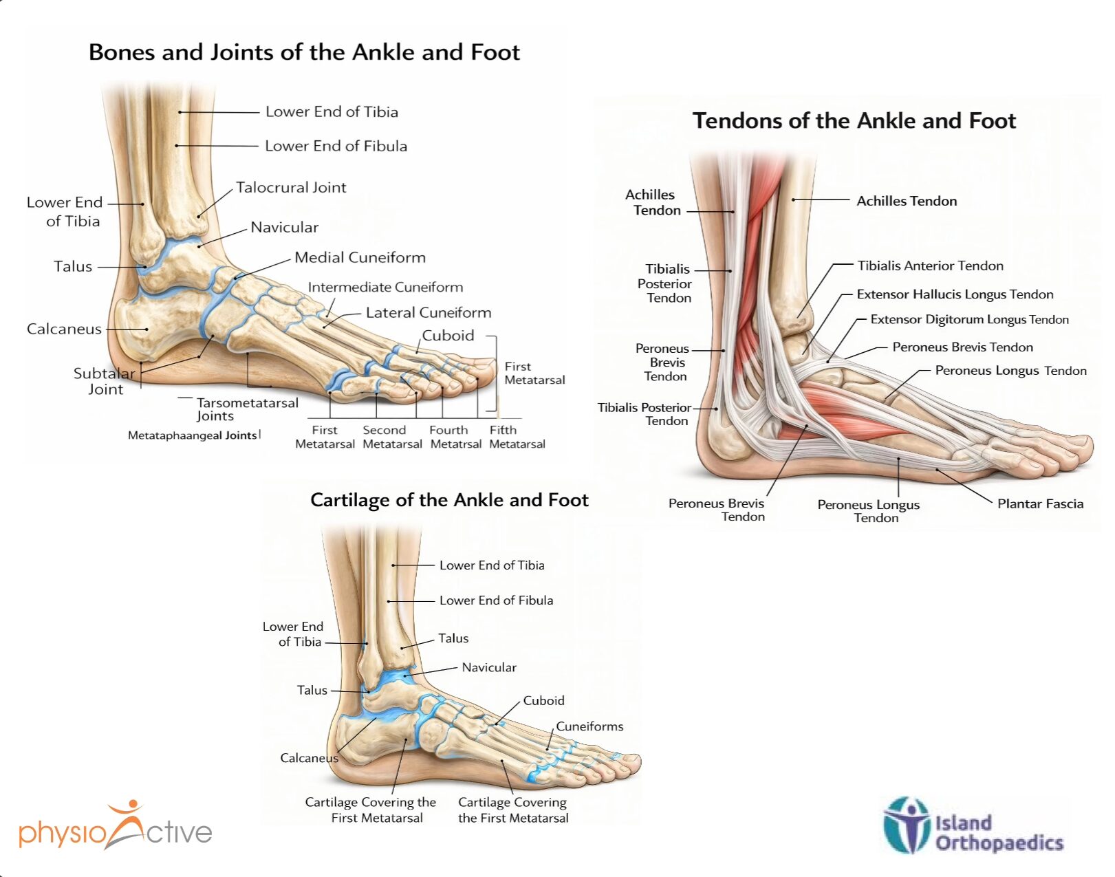 ankle sprains explained by Dr Gowreeson Thevendran